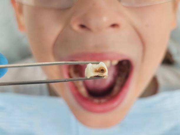 Best Emergency Dental Services for Seniors in Twin Lakes, VA